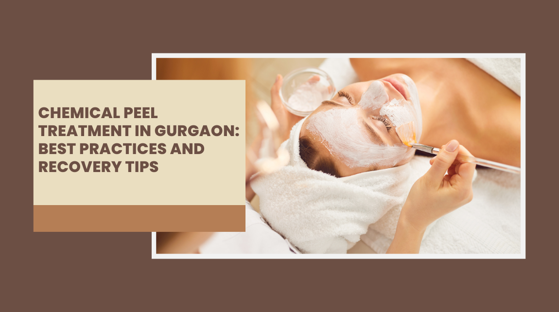 Acne Treatment in Gurgaon