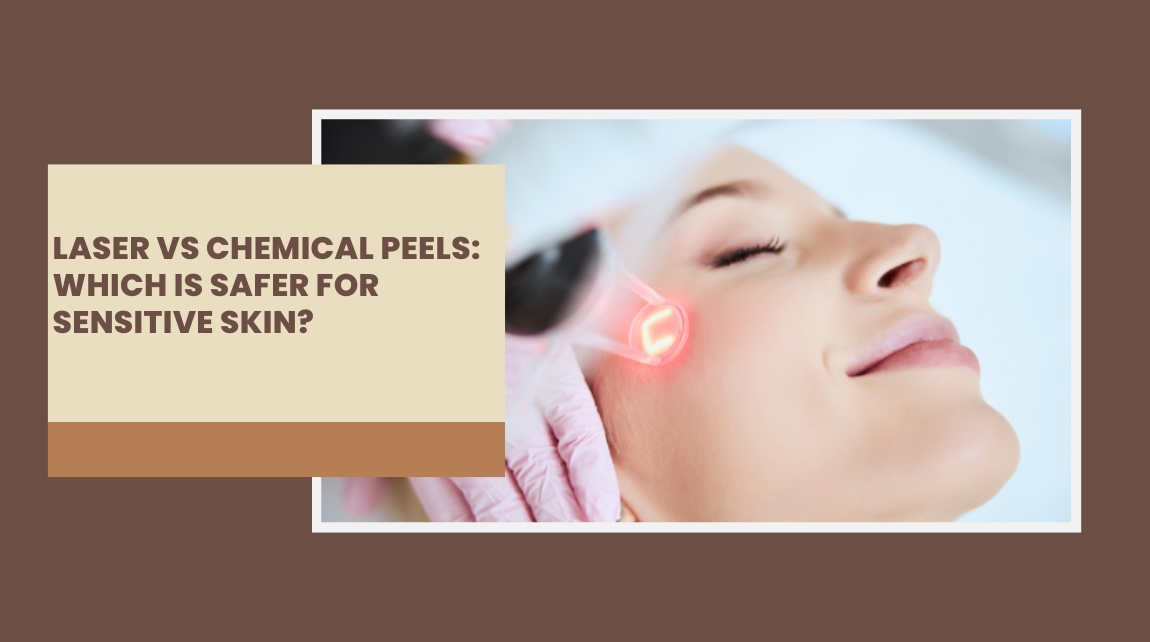 laser vs chemical peel