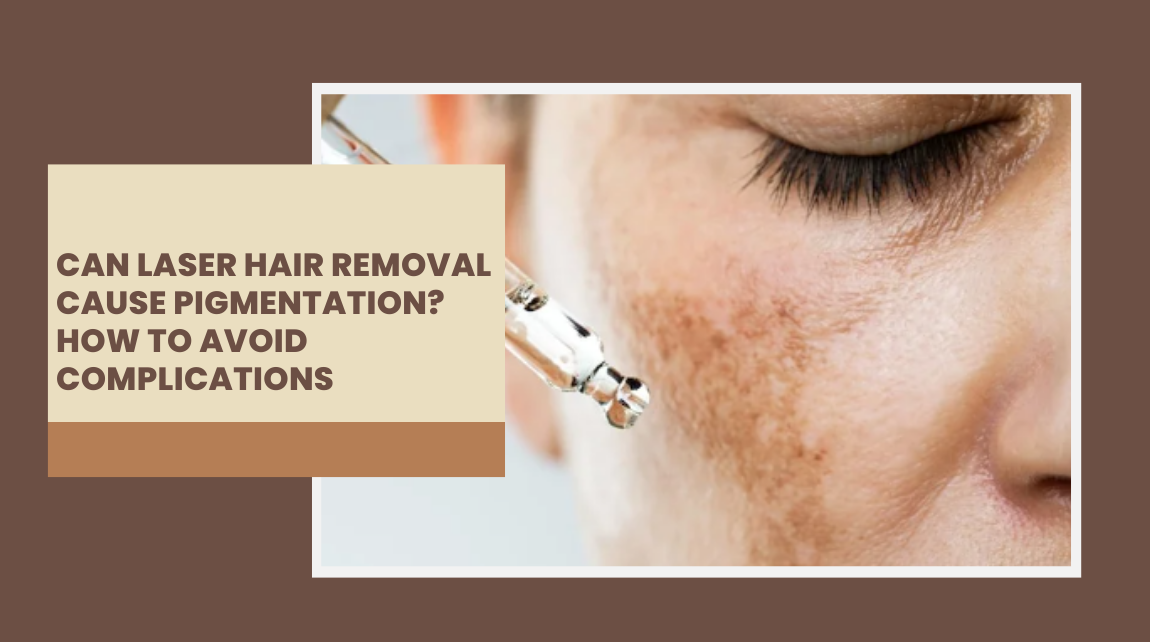 laser hair removal causes pigmentation