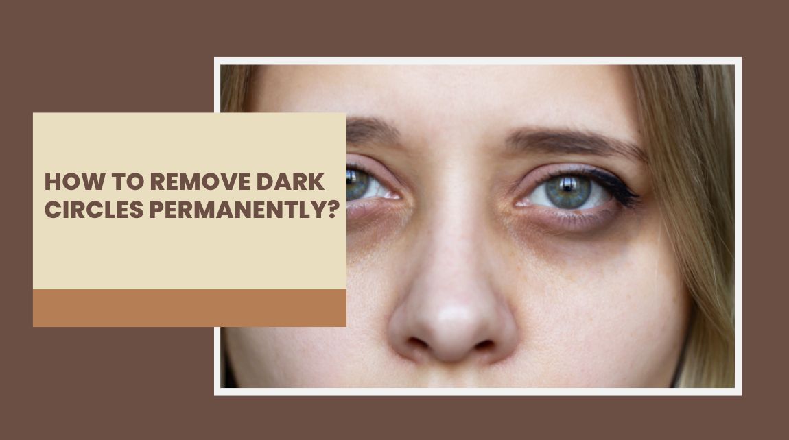 remove dark circle permanently